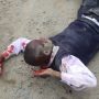 MDC-T Violence Victim Lying On The Floor