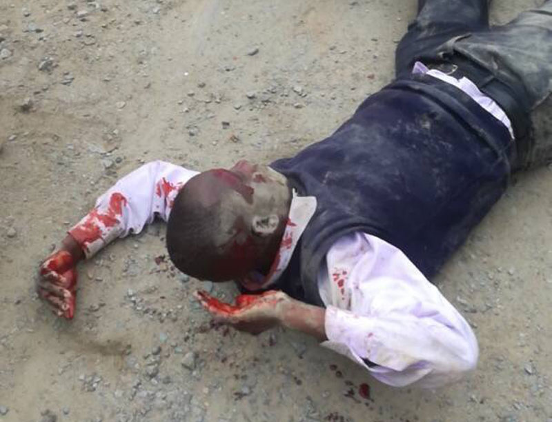 MDC-T Violence Victim Lying On The Floor