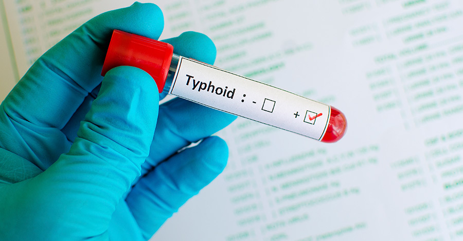 difference typhoid typhus conjugate vaccines