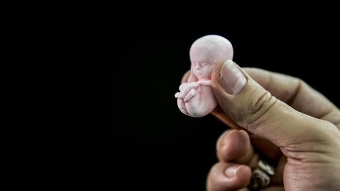 Doctor On The Run For Assisting Couple To Abort Pregnancy