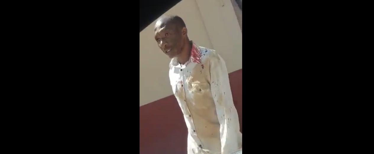 WATCH: Man With Broken Arm Says He Just Wants To Go Home #16AugustDemo