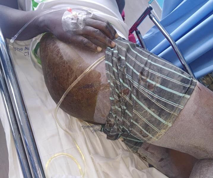 Human Rights Lawyers Tell The Government To Hold Account Perpetrators Of Torture