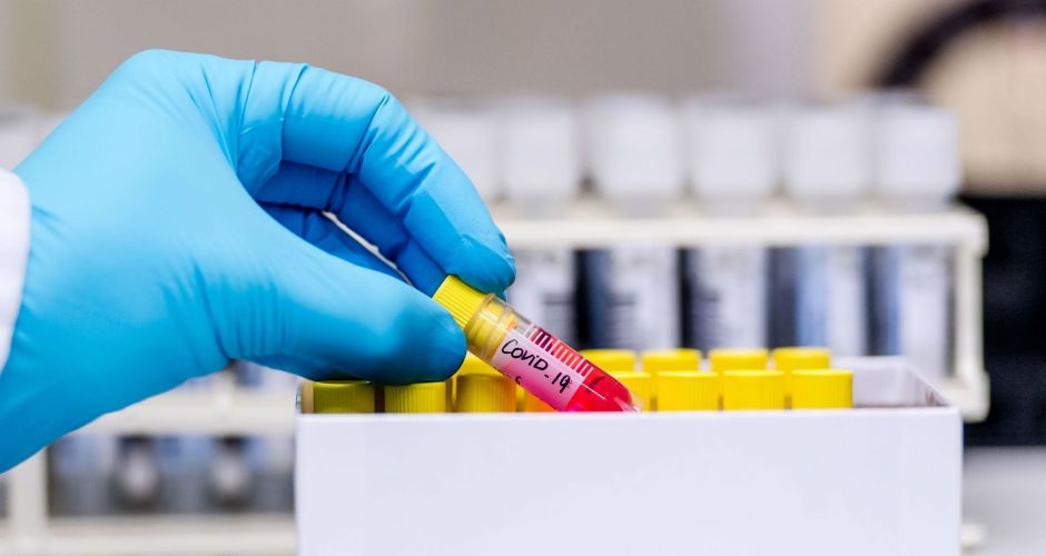 Coronavirus/COVID-19 Blood Sample Zimbabwe
