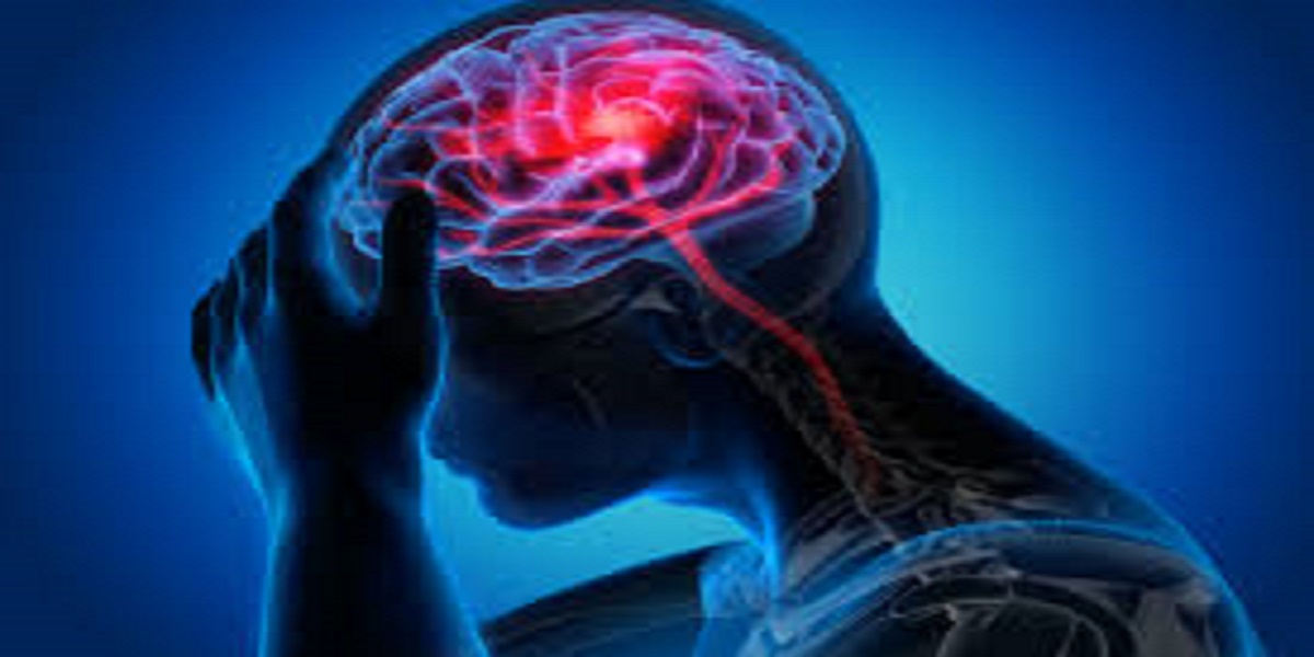 STROKE