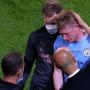KEVIN DE BRUYNE UCL Acute Nose Fracture