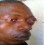 TINASHE BANDE ASSAULTED BY POLICE IN BOTSWANA Zimbabwean deformed