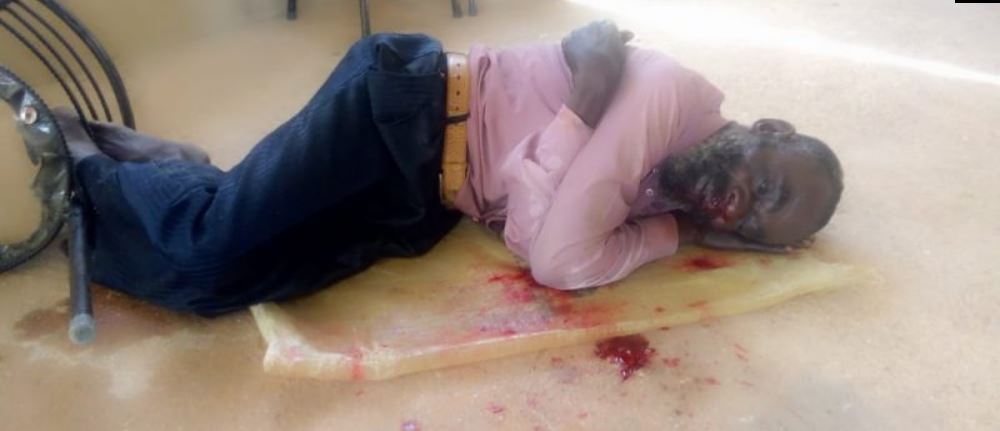 PICTURES: MDC Alliance Activists Attacked In Zvimba