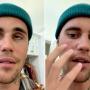 Justin Bieber Cancels Shows After Suffering From Facial Paralysis