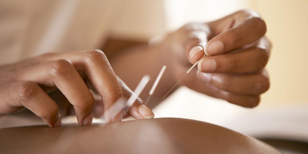 Zimbabwe’s First Locally-trained Acupuncturists Graduate
