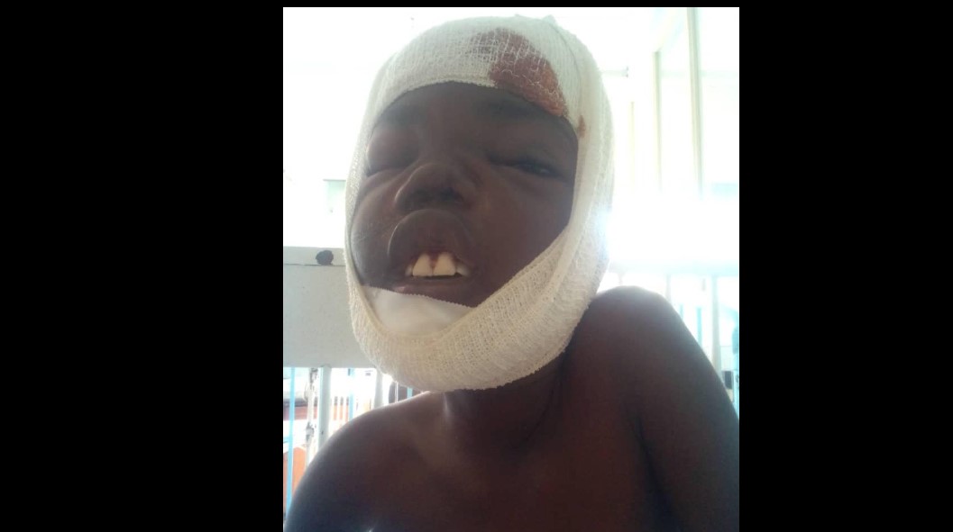 Chin'ono Says Harare Hospital Detains Victim Of Hippo Attack Over Outstanding Bill